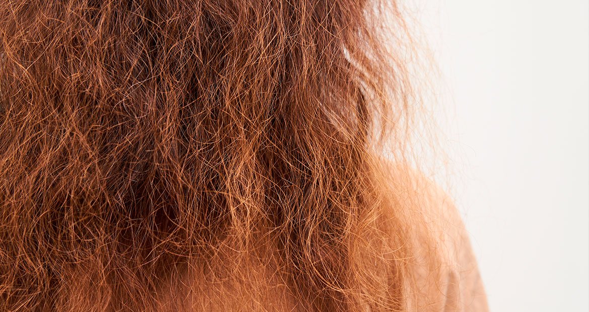 Cabelo danificado: saiba o que pode causá-lo